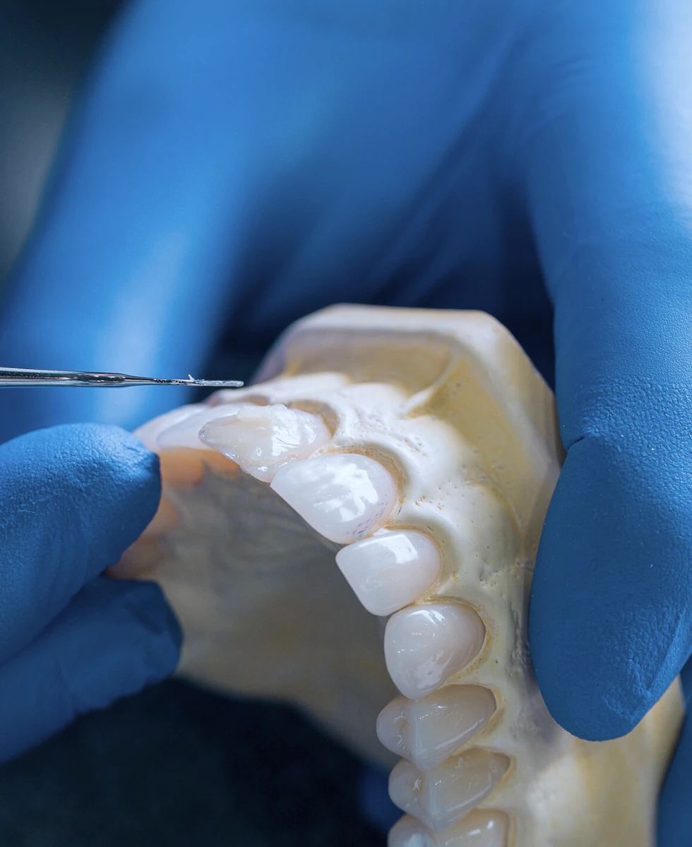 laboratoire de protheses fixes amovibles au Cabinet Dentaire des docteurs Yoh et Matton à Biarritz