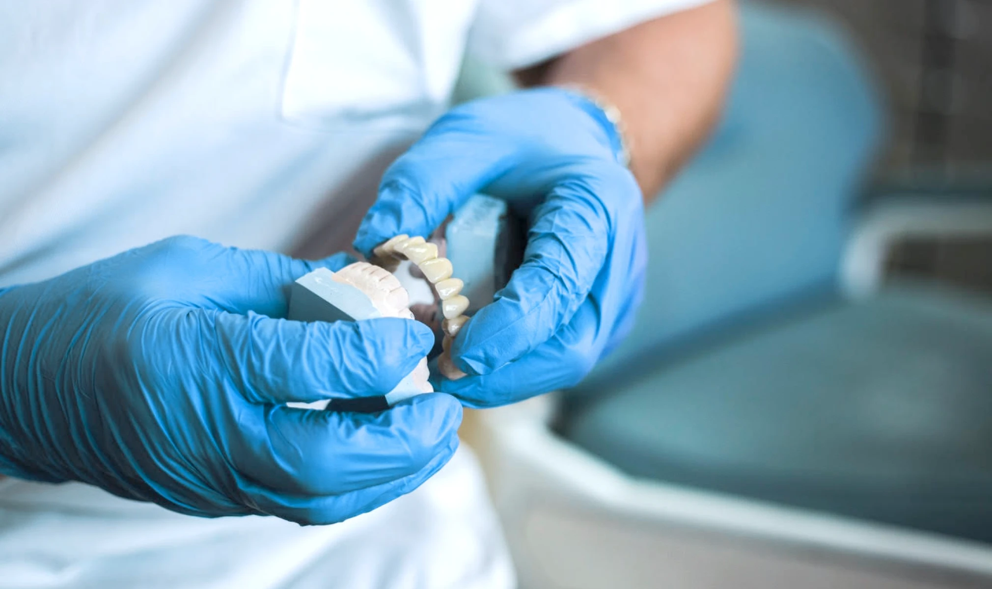 prothese provisoire au Cabinet Dentaire des docteurs Yoh et Matton à Biarritz