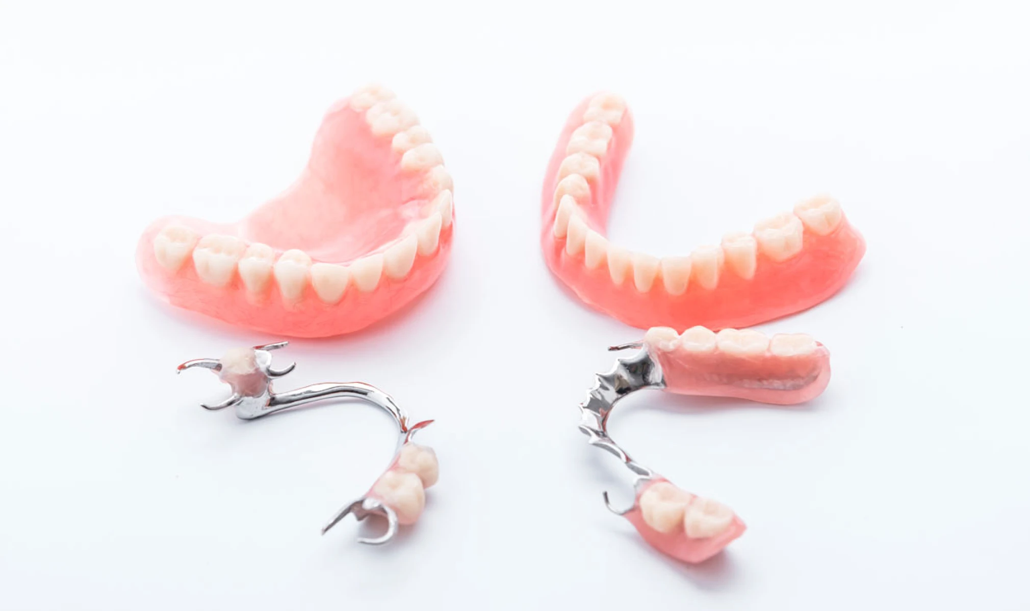 prothese squelettique au Cabinet Dentaire des docteurs Yoh et Matton à Biarritz